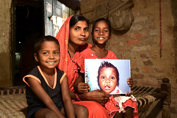 On World Cleft Awareness Day, Smile Train India Marks 800,000+ Free Surgeries and a Renewed Push for Early Diagnosis of Clefts